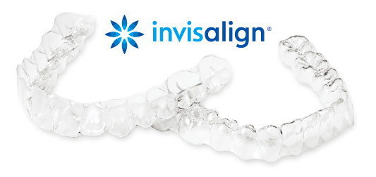 Invisalign Treatment